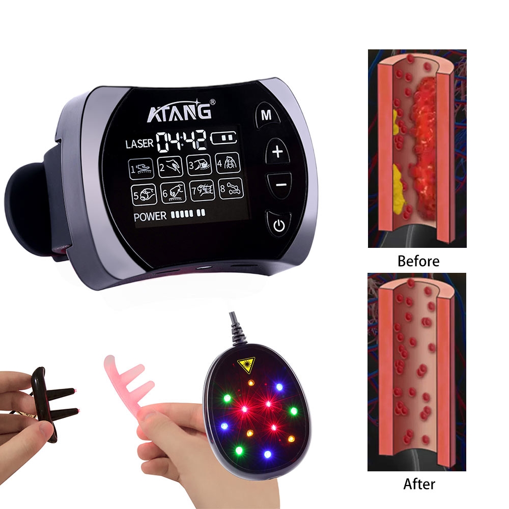 Trending Hot Selling 2023 Laser Watch LLLT Stroke Patients EMS Muscle Stimulation Alzheimer Cold Laser Watch For Hypertension