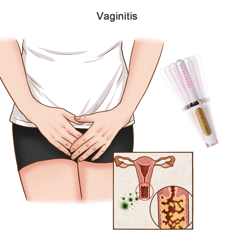 Laser Vaginal Tightening Rejuvenation Women Health Care Product Vagina Rehabilitation Cold Laser Therapy